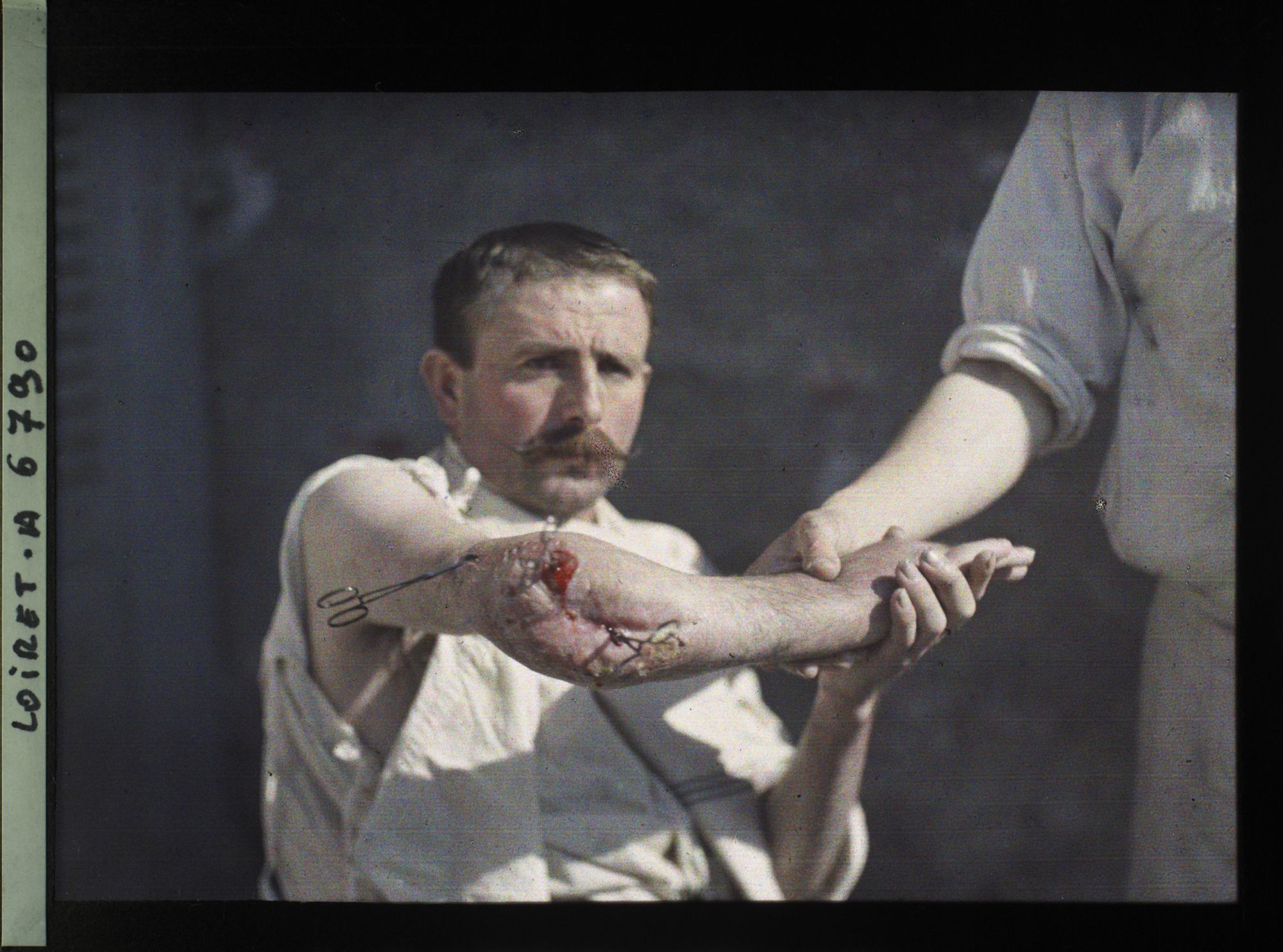 Image représentant Pierre Turbiau, blessé à l'hôpital militaire