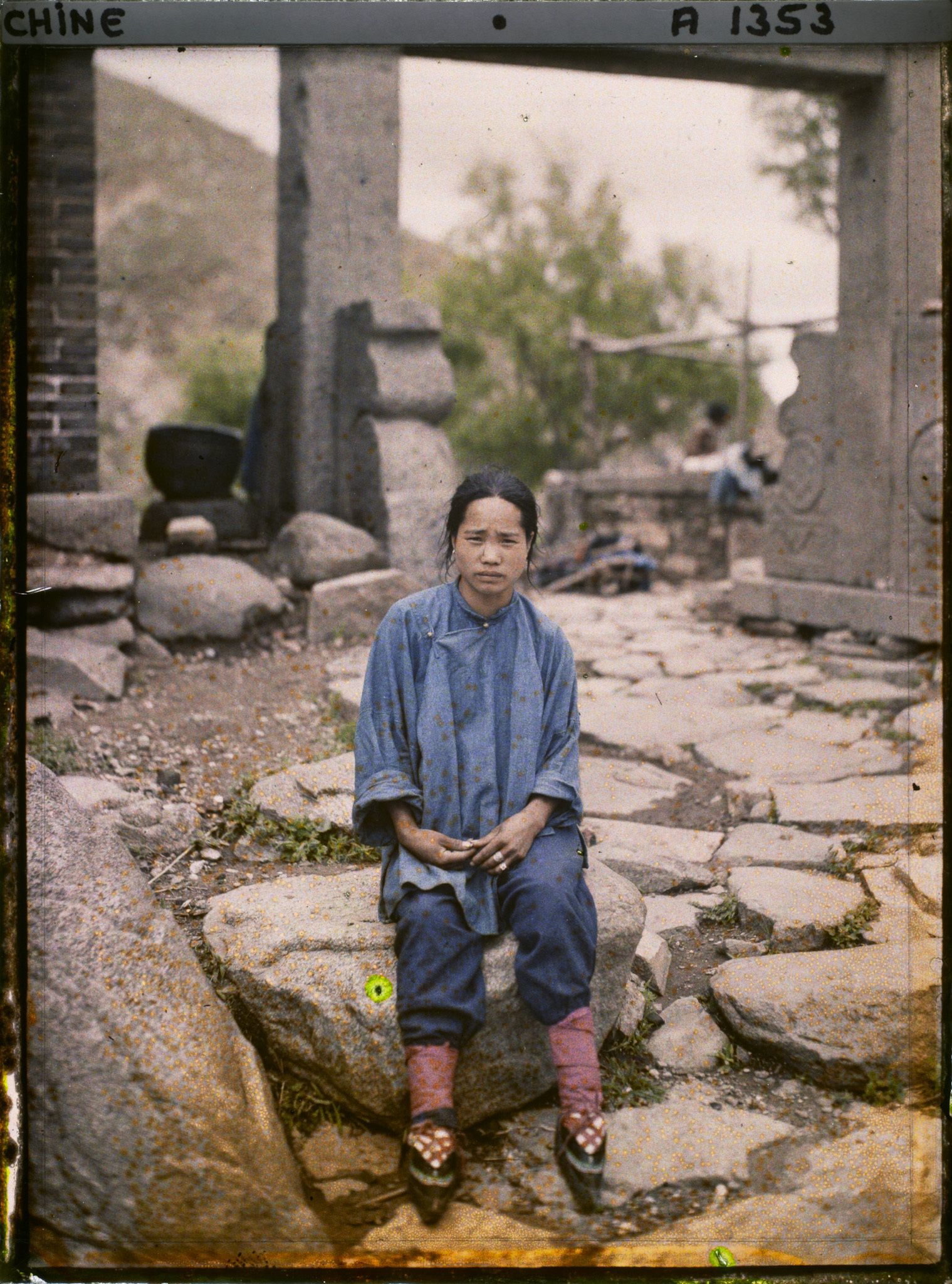 Image représentant Une jeune femme aux pieds bandés