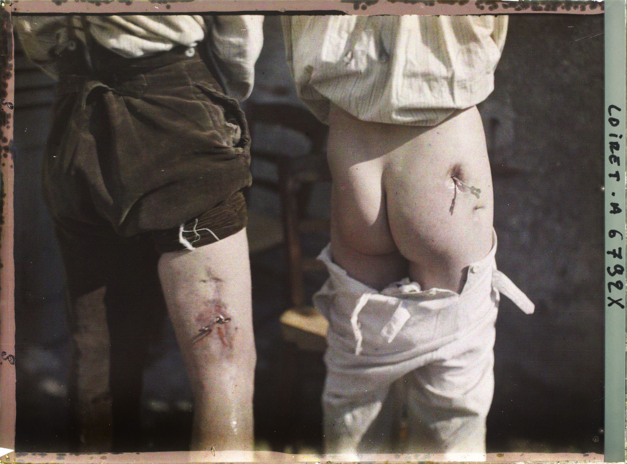 Image représentant France, Beaugency, Hopital militaire 47. Barthelot de Domery (Loiret) blessé le 8 septe 1914