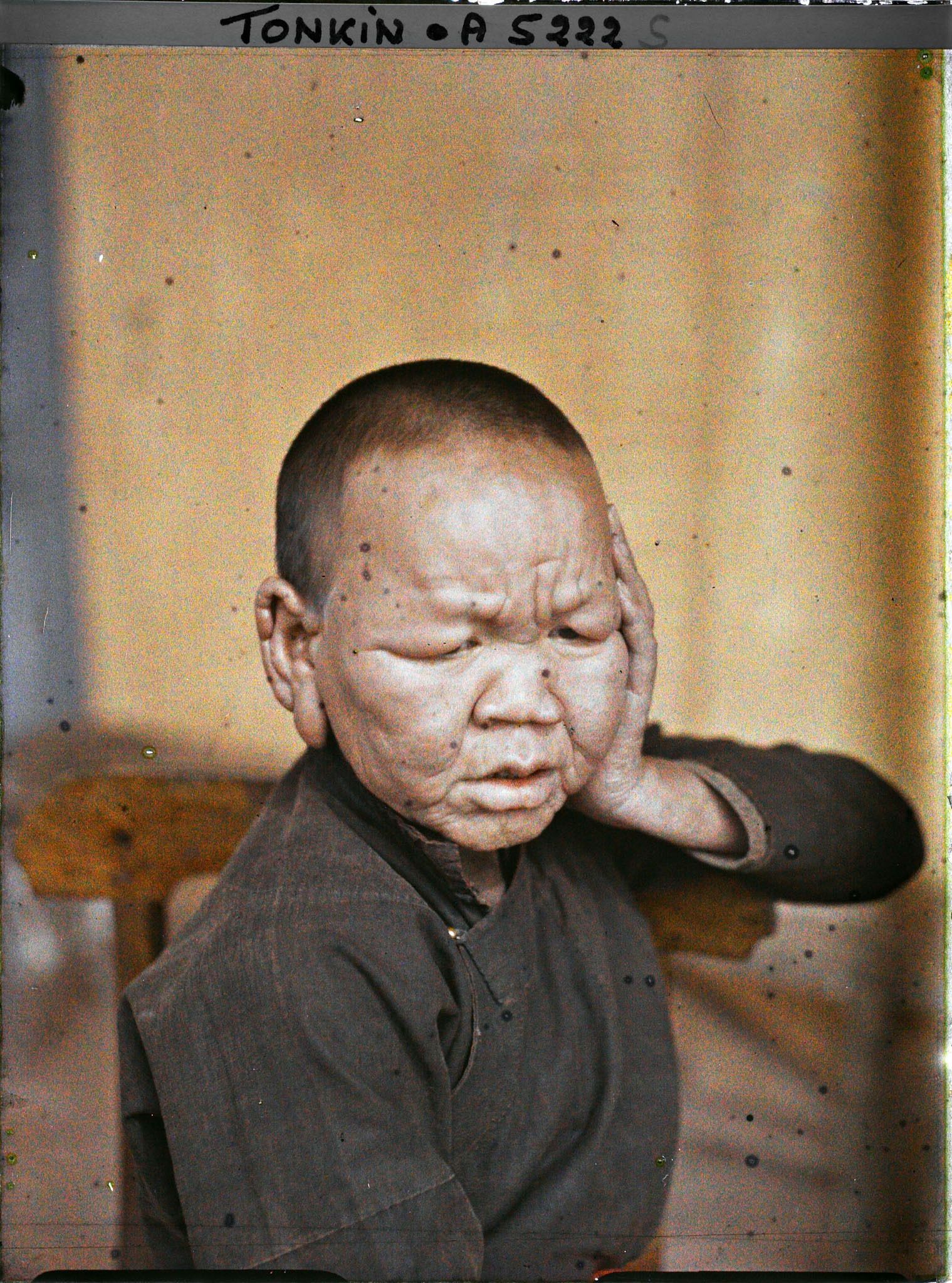 Image représentant Un lépreux dans une léproserie de Du'ô'ng-té