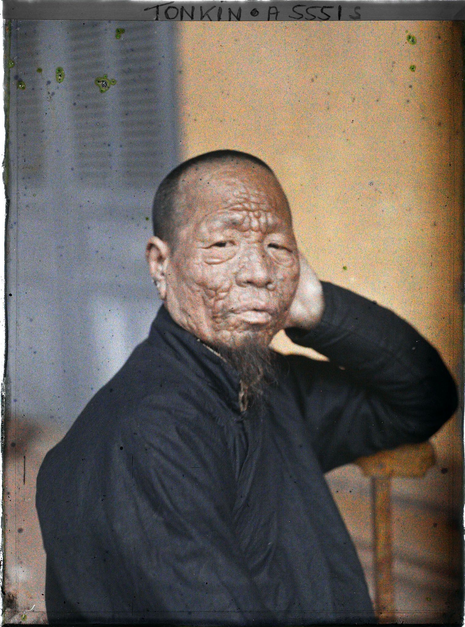 Image représentant Un lépreux dans une léproserie de Du'ô'ng-té