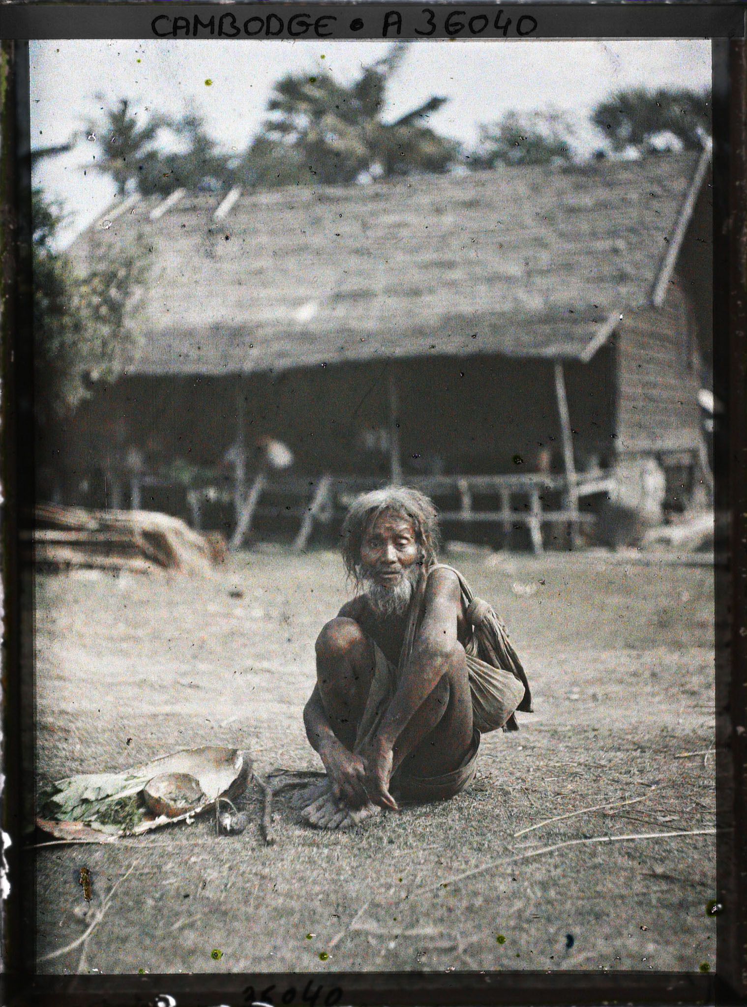 Image représentant Un mendiant lépreux