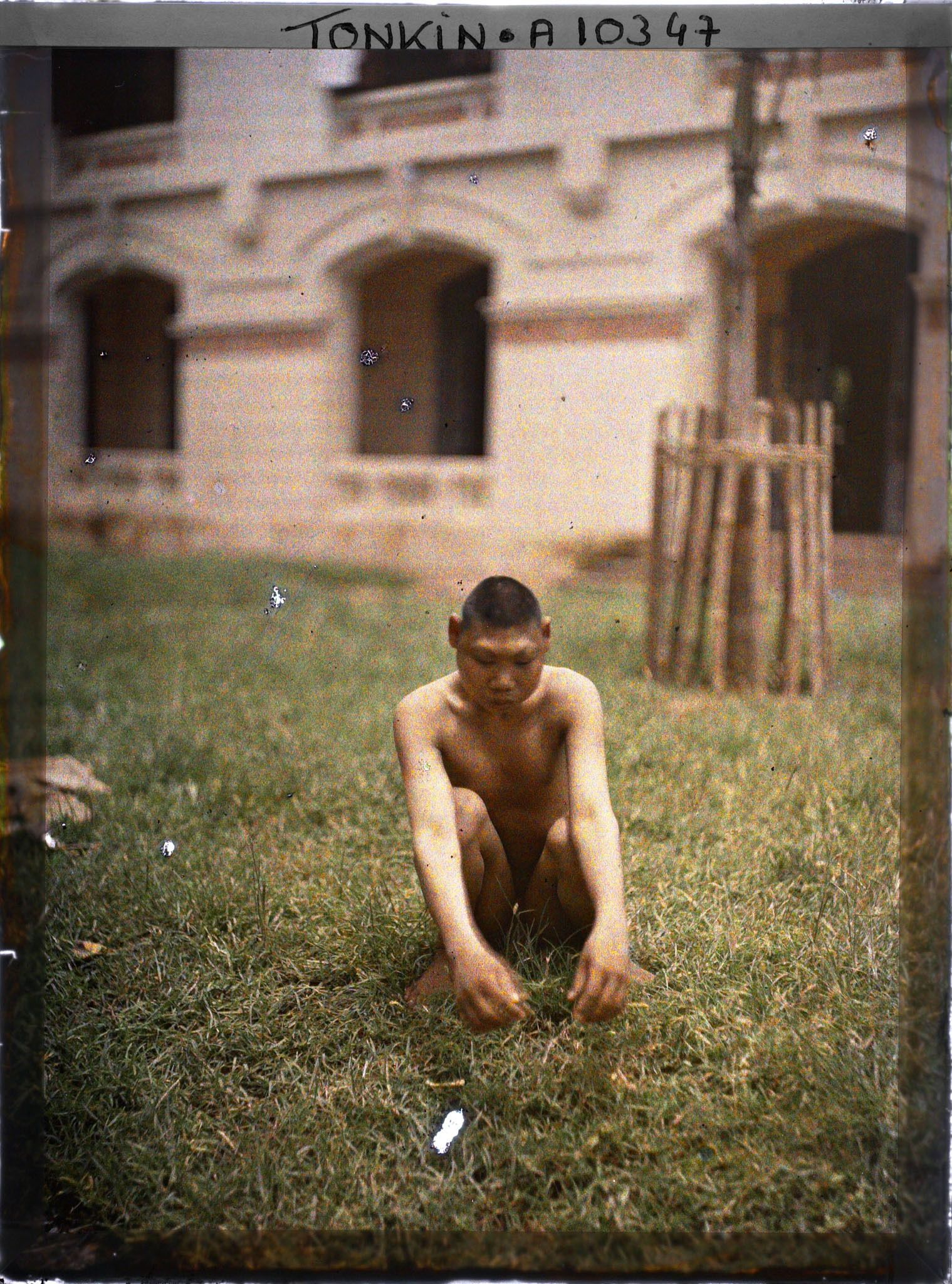 Image représentant Un microcéphale à l'hôpital d'Hà-nôi (?)