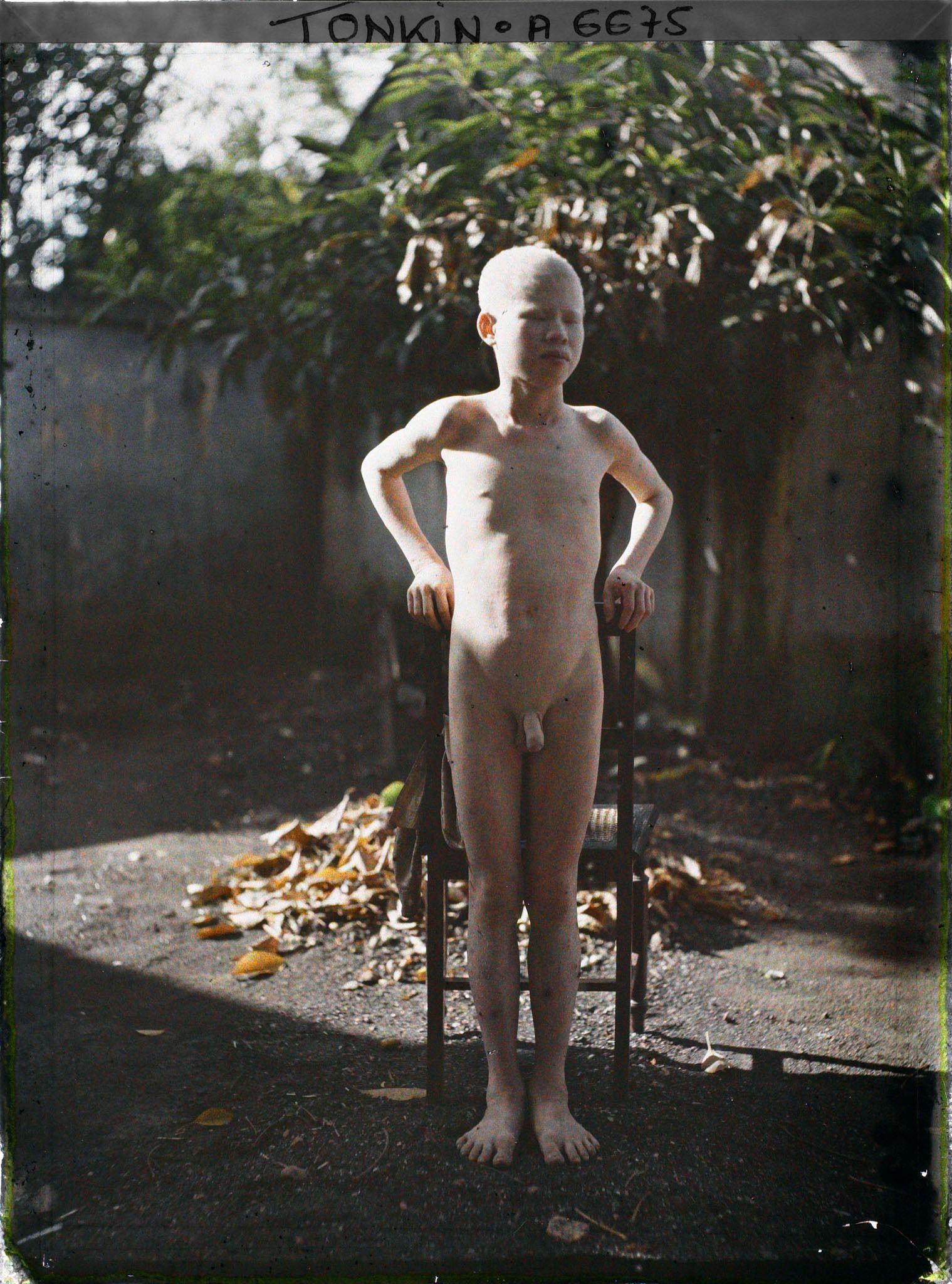 Image représentant Un jeune albinos debout