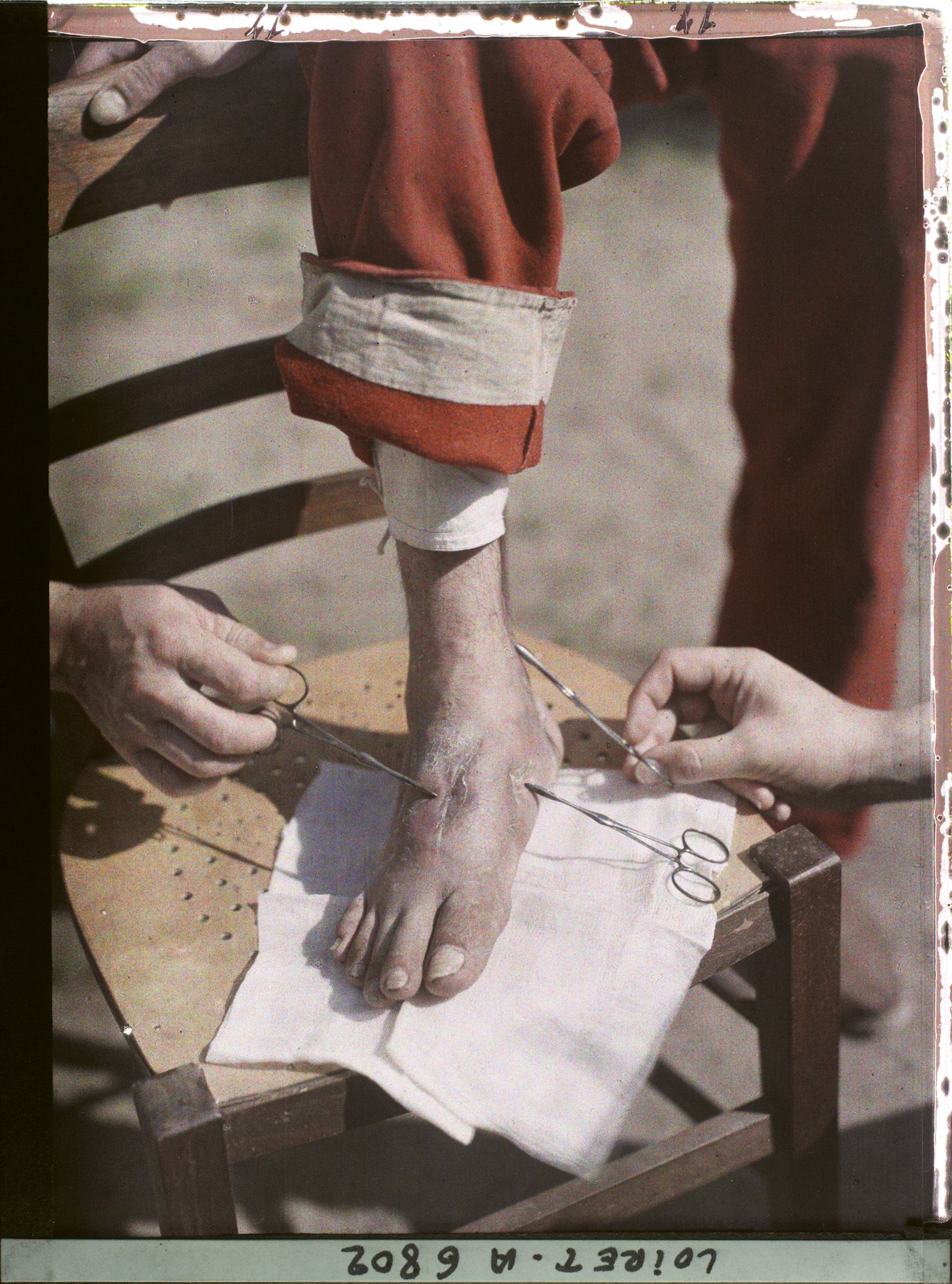 Image représentant France, Beaugency, Hopital militaire 47. Legay, pied guéri en 20 jours, 3 fistules suppurantes depuis 5 mois