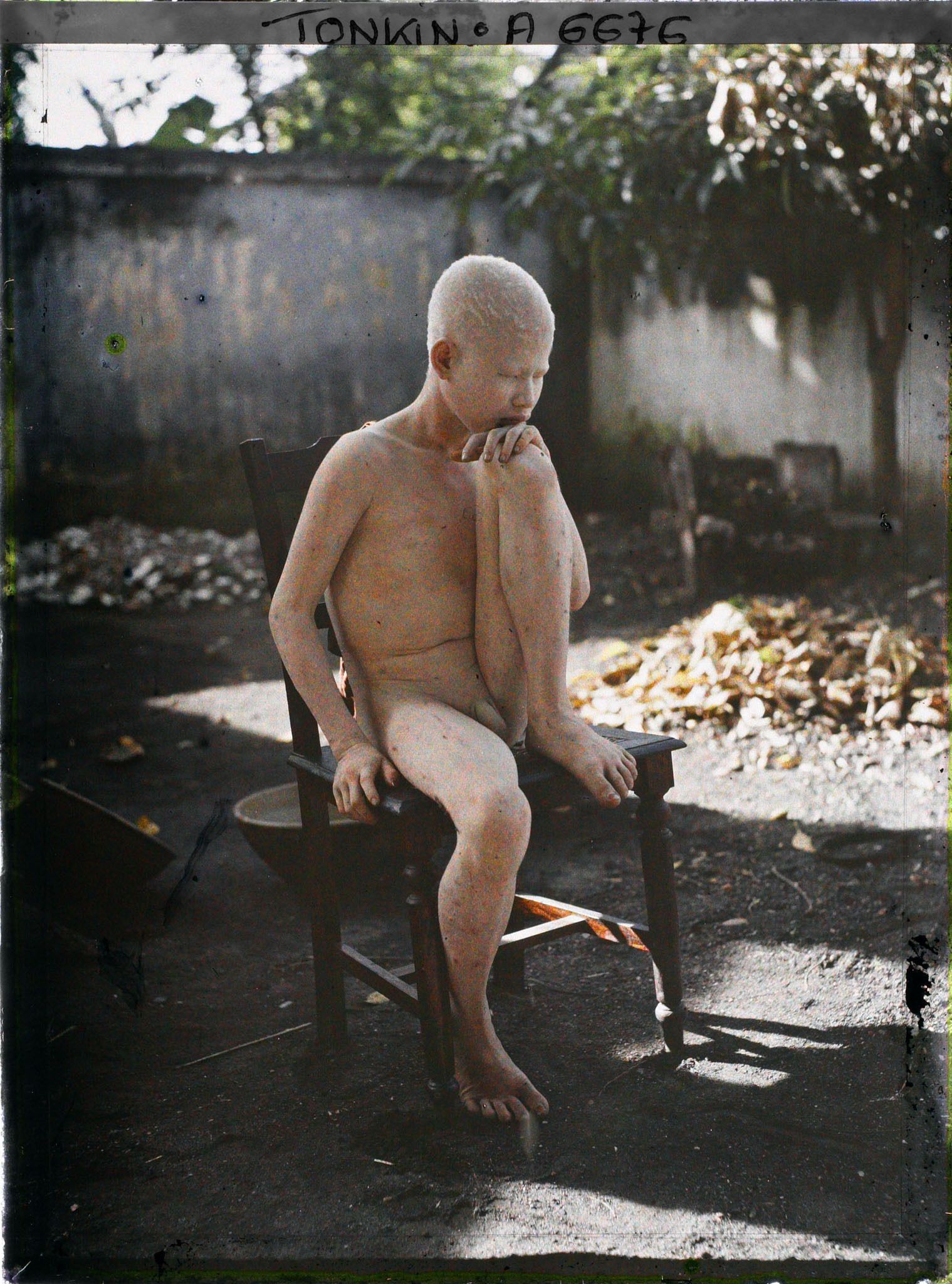 Image représentant Un jeune albinos assis