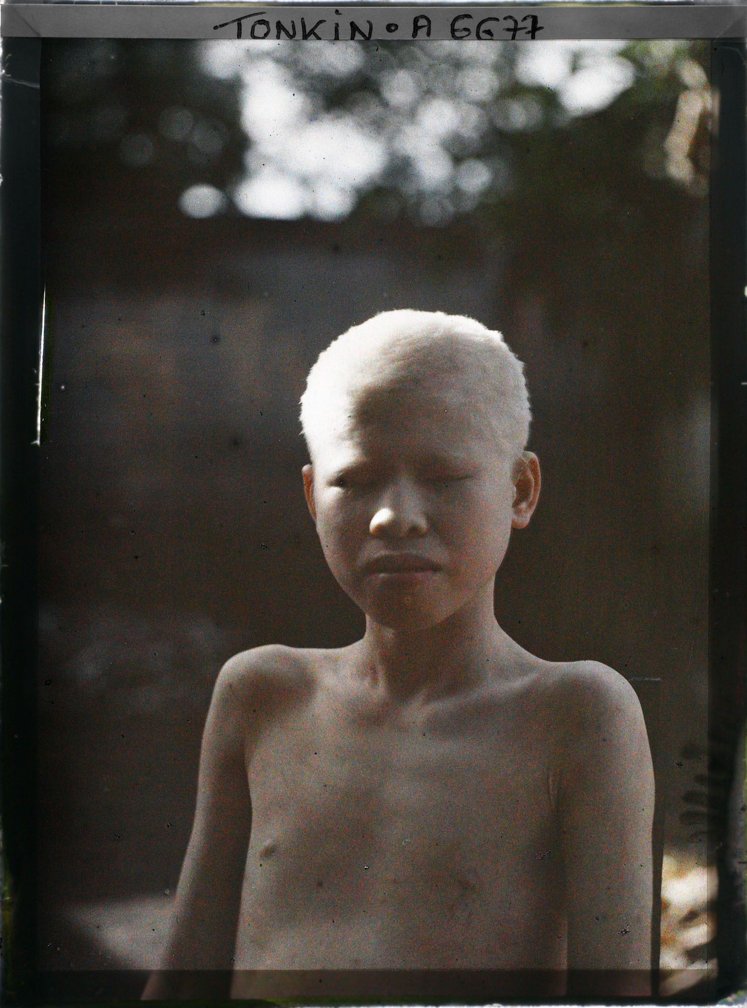 Image représentant Un portrait en buste d'un jeune albinos