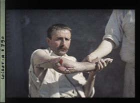 Image représentant Pierre Turbiau, blessé à l'hôpital militaire