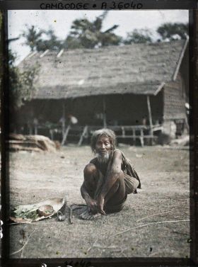 Image représentant Un mendiant lépreux