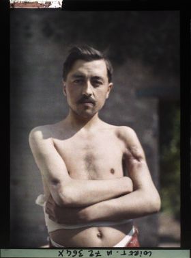 Image représentant M. Marot, originaire de Vendée, posant dans la cour de l'hôpital militaire