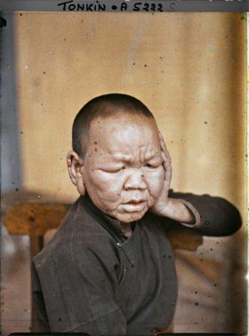 Image représentant Un lépreux dans une léproserie de Du'ô'ng-té