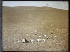 Image représentant Des ossements humains