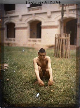 Image représentant Un microcéphale à l'hôpital d'Hà-nôi (?)