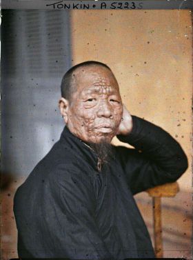 Image représentant Un lépreux dans une léproserie de Du'ô'ng-té