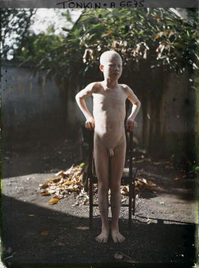 Image représentant Un jeune albinos debout