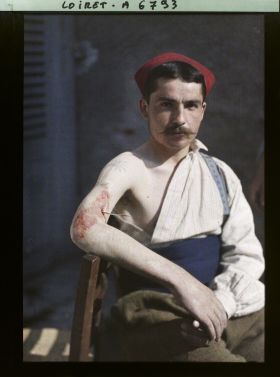 Image représentant France, Beaugency, Hopital militaire 47. Tresseurs, de Montauban, un bras avec palmier tatoué