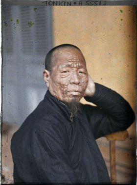 Image représentant Un lépreux dans une léproserie de Du'ô'ng-té