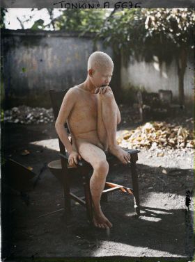 Image représentant Un jeune albinos assis