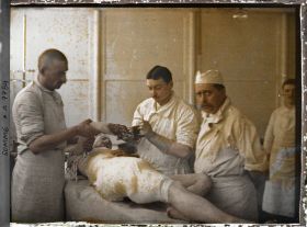 Image représentant Hôpital d'évacuation de Moreuil. Blessures produites par les éclats d'obus