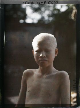 Image représentant Un portrait en buste d'un jeune albinos
