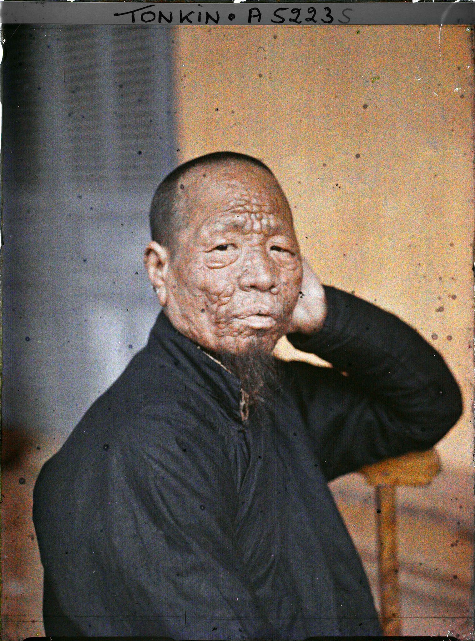 Image représentant Un lépreux dans une léproserie de Du'ô'ng-té