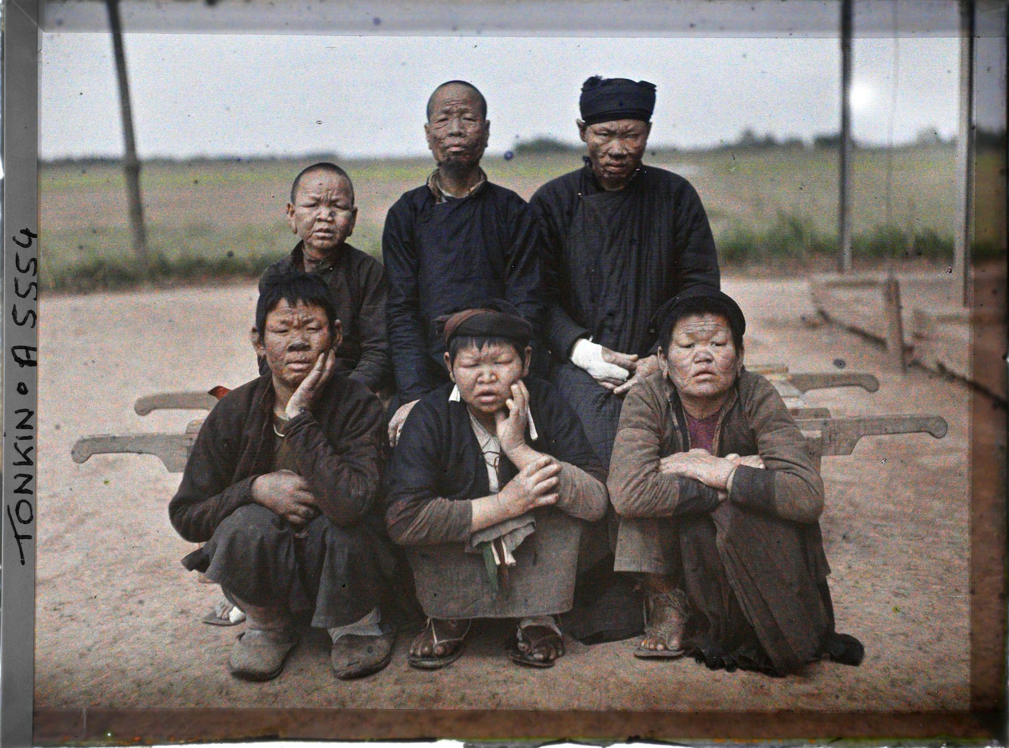 Image représentant Un groupe de lépreux dans une léproserie de Du'ô'ng-té